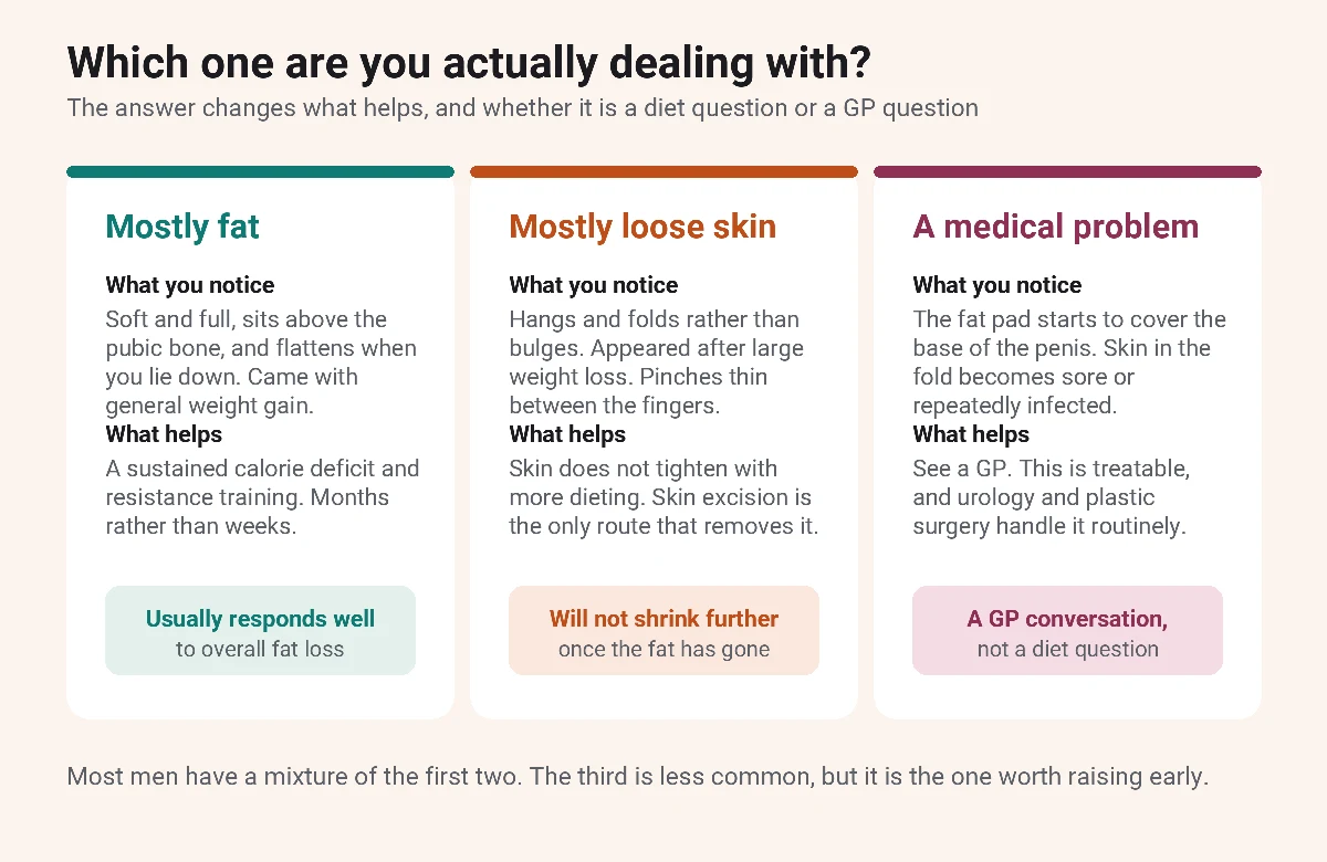 Three-column comparison showing how to tell whether a male FUPA is mostly fat, mostly loose skin, or a medical problem needing a GP