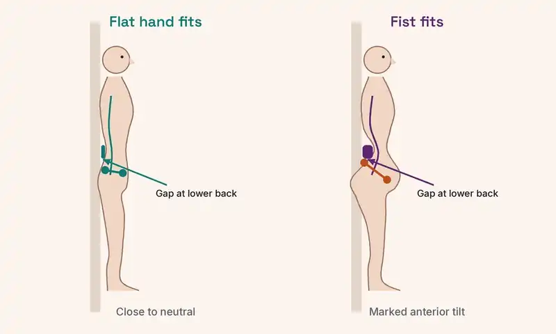 Diagram of the wall test for pelvic tilt: a flat hand gap at the lower back suggests a neutral pelvis, while a fist-sized gap suggests anterior pelvic tilt