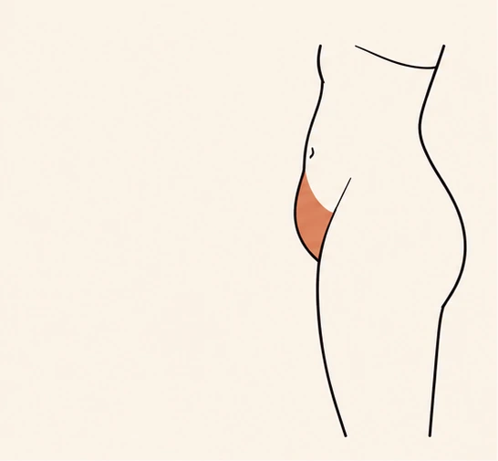 What Does a FUPA Look Like?