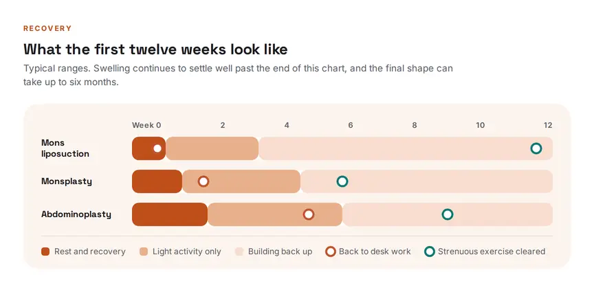 Chart comparing recovery after mons liposuction, monsplasty and abdominoplasty across the first twelve weeks, marking the return to desk work and to strenuous exercise