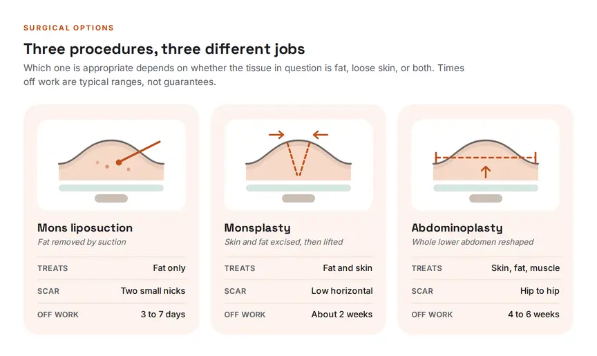 Diagram comparing mons liposuction, monsplasty and abdominoplasty, showing what each removes from the skin and fat layers, where the scar sits and typical time off work