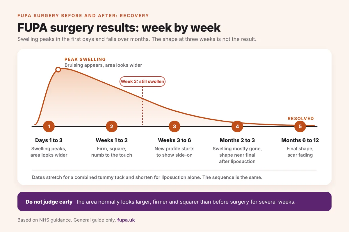 Timeline diagram showing swelling and shape changes after FUPA surgery from days 1 to 3 through to months 6 to 12