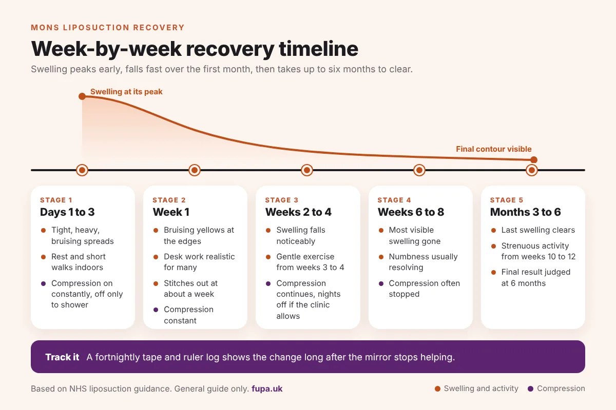 Horizontal timeline of mons liposuction recovery from days 1 to 3 through to months 3 to 6, showing swelling, activity and compression at each stage